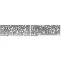 1/24 SCALE PORSCHE 911 GT3 Model Kit